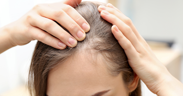 can wigs cause hair loss